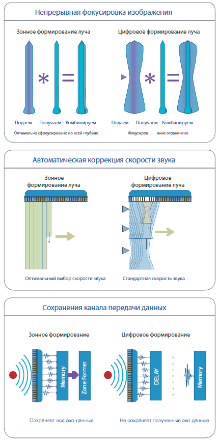 Отличия ZONARE ZS3