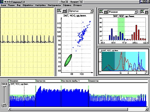 Heart rate analysis