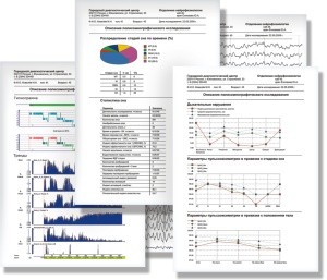 Polysomnographic studies