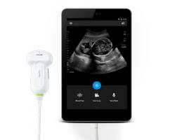 Стетоскоп XXI века. Обзор ручных УЗИ-сканеров
