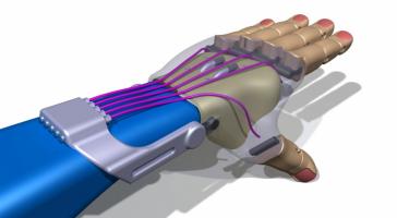 Протезирования с помощью 3D-печати