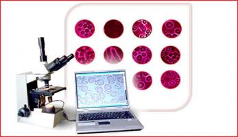 Новый гемотест обнаруживает инфекцию за несколько минут