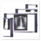 Негатоскопы для просмотра рентгеновских снимков Dixion X-View